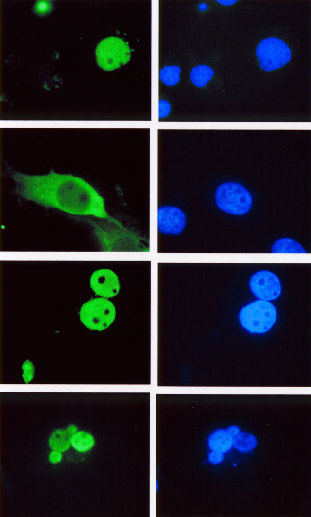 Figure 1. Immunofluorescence staining of Cos-1 cells transfected with (top to bottom) full length hLEF-1, a LEF-1 mutant missing the nuclear localization signal, TCF-4 and TCF -1. Cells were stained with Exalpha’s LEF-1 antibody, clone REMB6 cat. # T105M and visualized with FITC conjugated mouse IgG. DAPI was used to detect all nuclei. The LEF/TCF/HMG, clone REMB6 recognizes an epitope in the highly conserved HMG DNA binding domain.